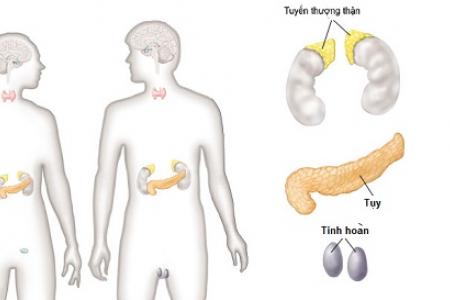 Tăng sản thượng thận bẩm sinh - Hình ảnh minh họa